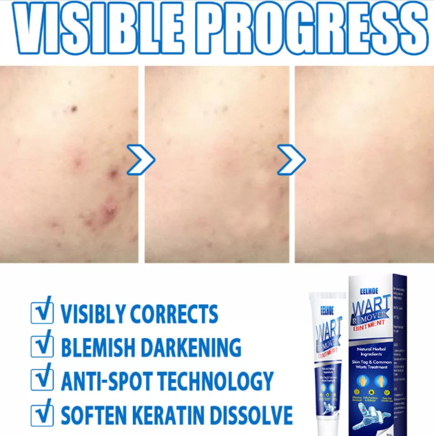 🌿 CREMA PARA ELIMINAR VERRUGAS SUMIFUN