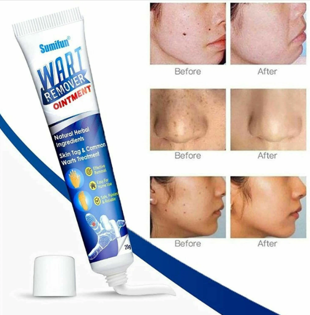 🌿 CREMA PARA ELIMINAR VERRUGAS SUMIFUN
