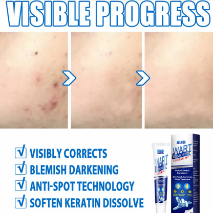 🌿 CREMA PARA ELIMINAR VERRUGAS SUMIFUN